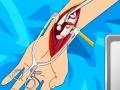 遊戲Arm surgery 2