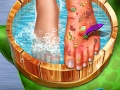 遊戲Feet Skin Doctor