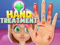 遊戲Hand Treatment