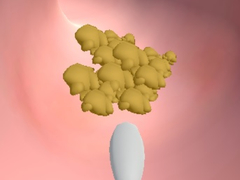 遊戲Earwax Clinic